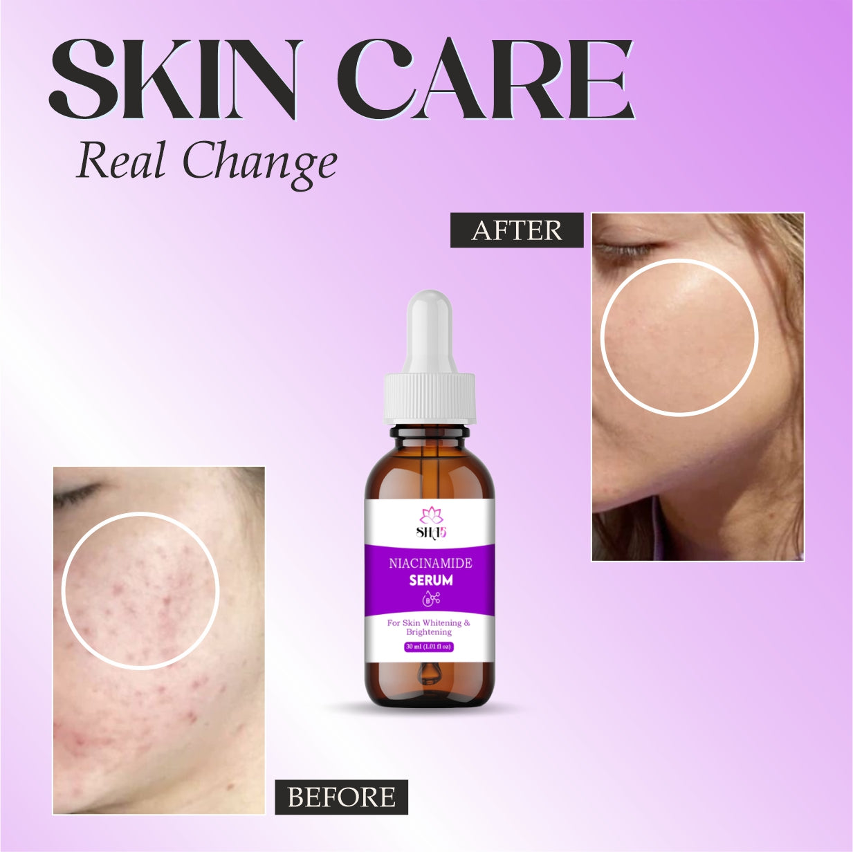 Niacinamide Serum 10% with Zinc – Hydrating Facial Serum for Pore Minimizing, Oil Control & Blemish Care – Brightening Vitamin B3 Serum for Clear, Smooth Skin – 30ml