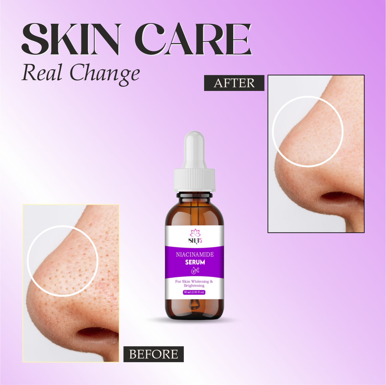 Niacinamide Serum 10% with Zinc – Hydrating Facial Serum for Pore Minimizing, Oil Control & Blemish Care – Brightening Vitamin B3 Serum for Clear, Smooth Skin – 30ml