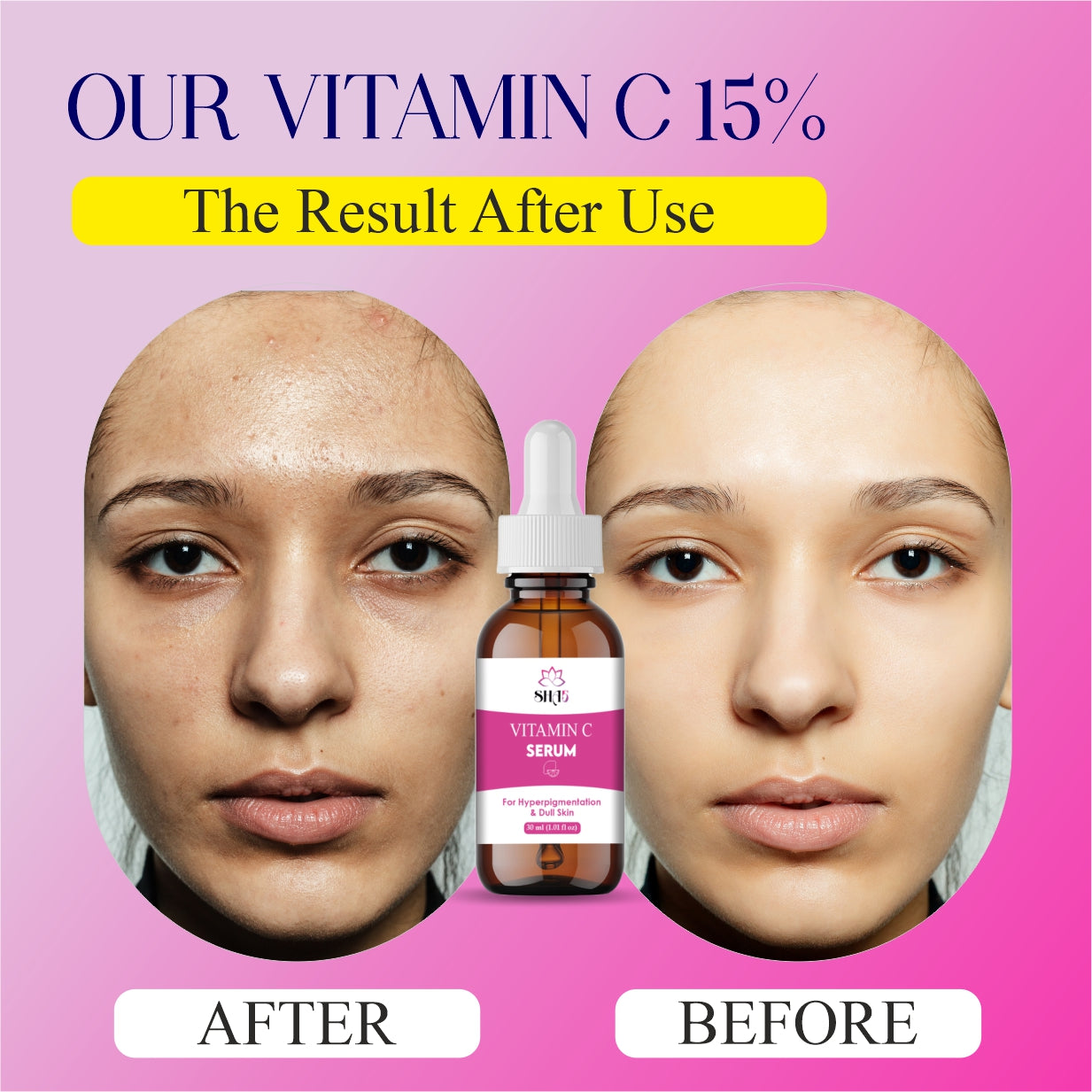 Vitamin C Serum for Face – 20% Pure Vitamin C + Hyaluronic Acid + Vitamin E – Anti Aging & Brightening Serum – Reduces Wrinkles, Dark Spots & Fine Lines