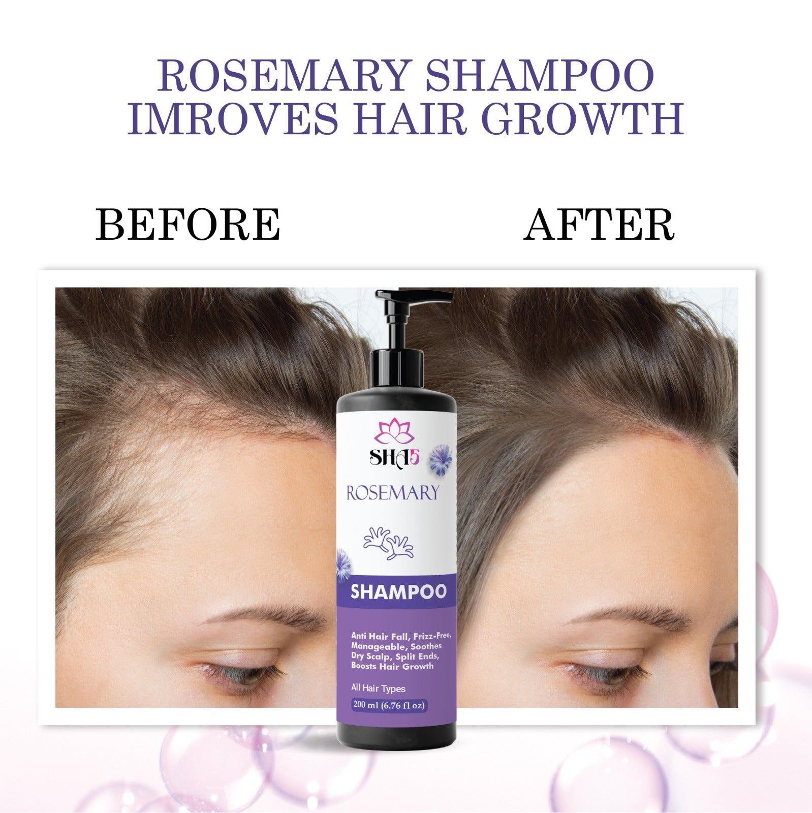Rosemary Shampoo for Hair Growth – Sulfate-Free, Natural Thickening Shampoo with Biotin & Peppermint – Nourishing Scalp Treatment for Thinning Hair & Dry Scalp – Men & Women
